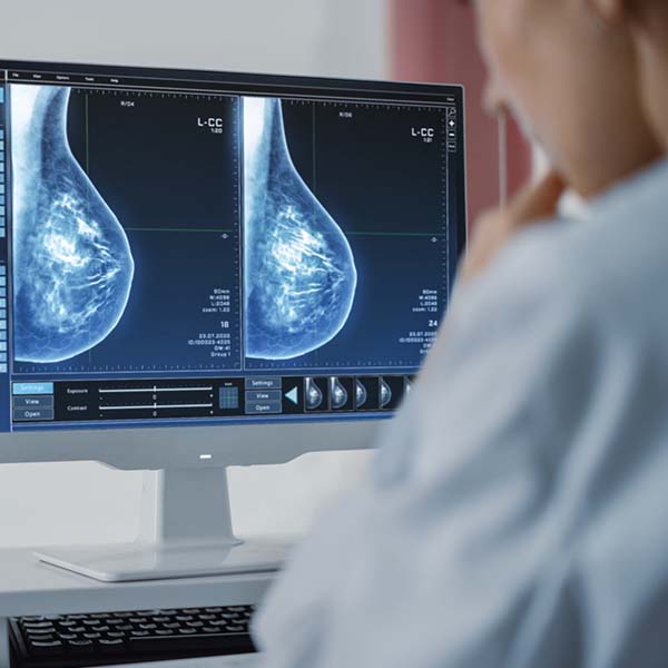 Senographe Essential – un nou capitol în istoria mamografiei cu tomosinteză – la Centrul de Sănătate a Sânului Arcadia