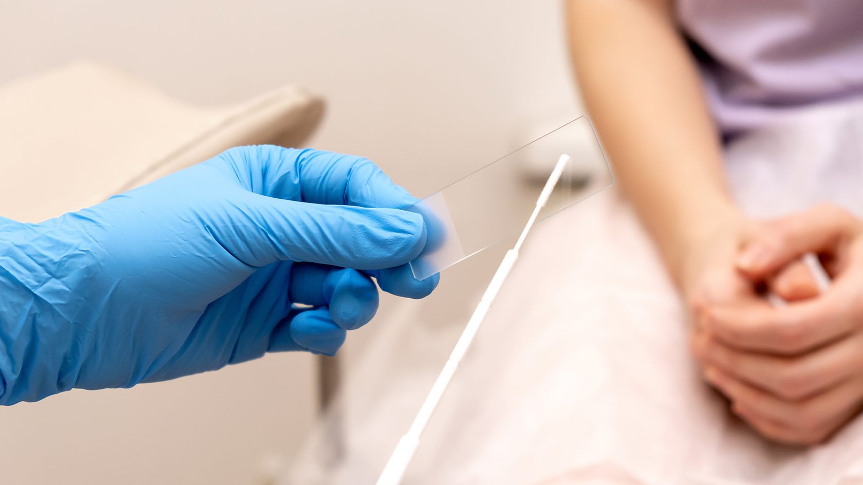 Testul Papanicolau: un test esențial pentru depistarea timpurie a cancerului de col uterin